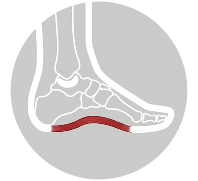 Plantar Fasciitis
