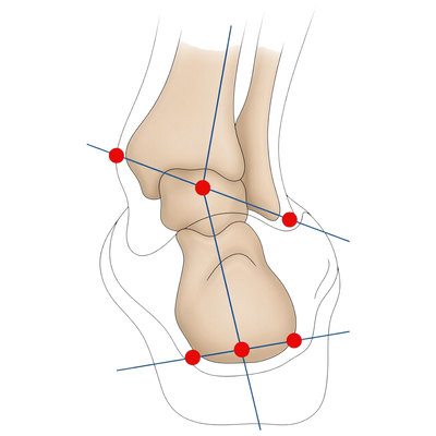 Pronation