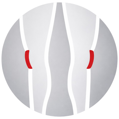 knee pain